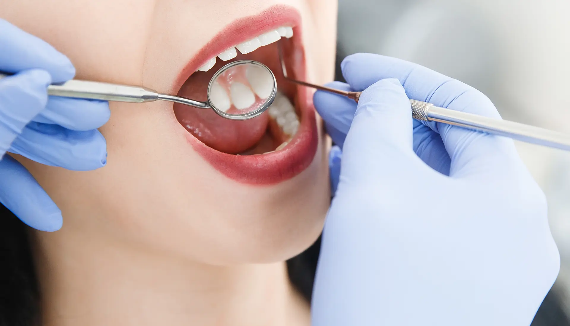 Igiene Orale e Sbiancamento - Studio dentistico Azzolina Gozzi - Sorridi dalla prima infanzia alla terza età