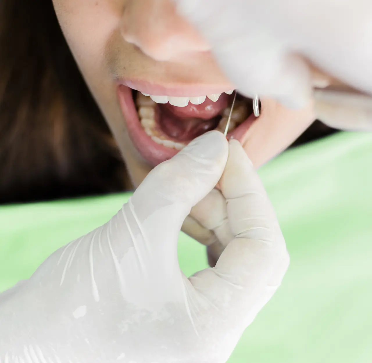 Terapia Endodontica a Forlì - Studio dentistico Azzolina Gozzi - Sorridi dalla prima infanzia alla terza età